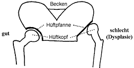 Hüftdysplasie