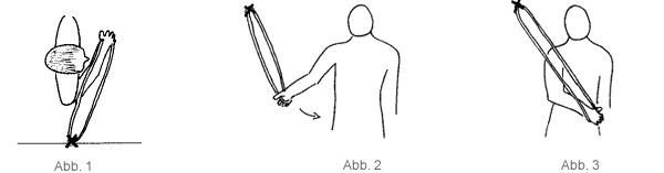 Impingment Syndrom