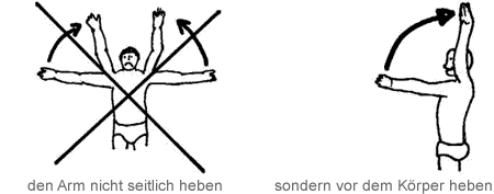 Rotatoren - Manschetten - Ruptur