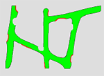 Knochenstoffwechsel