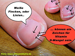 Nagellinien